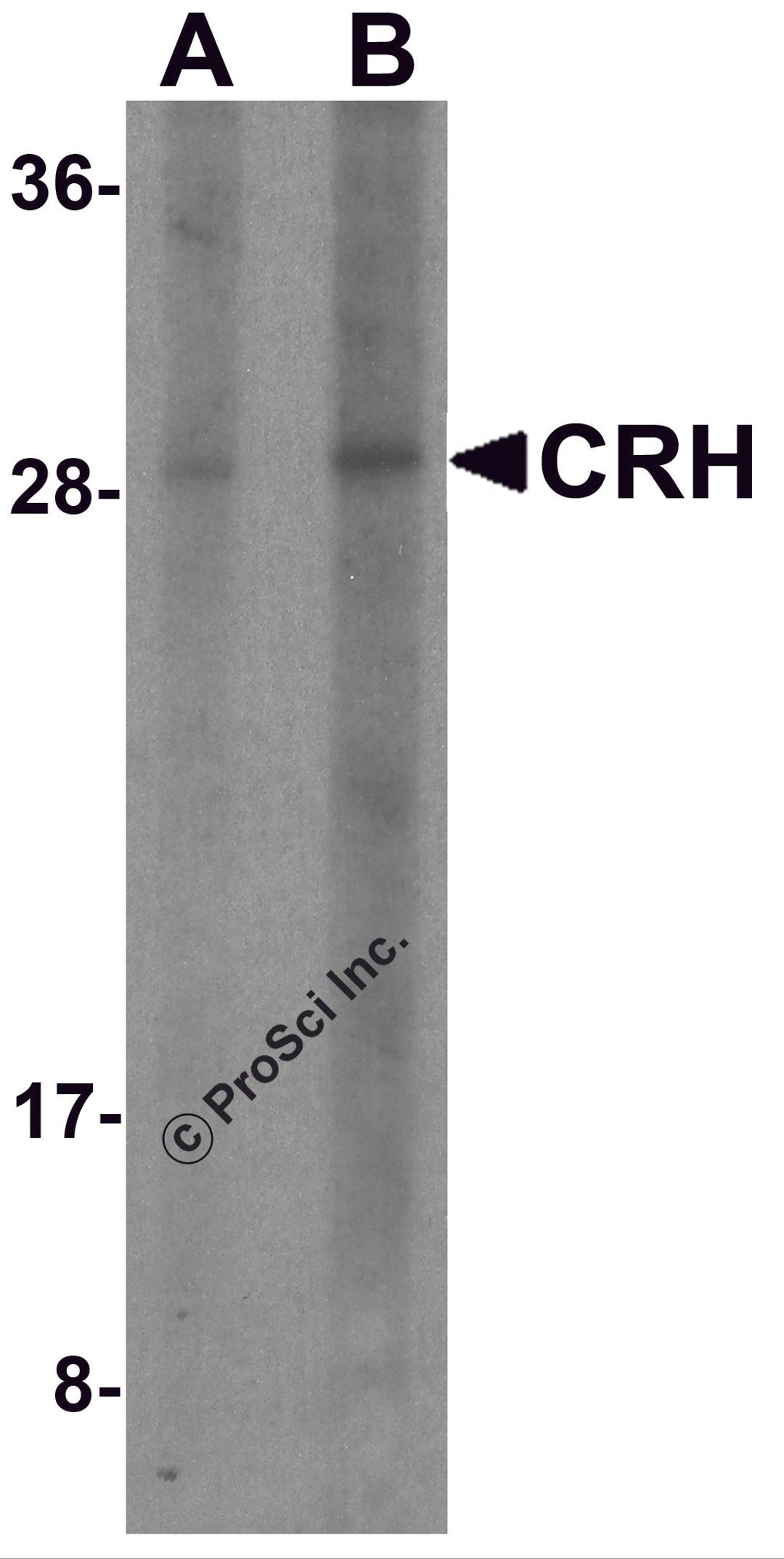 Western blot analysis of CRH in human placenta tissue lysate with CRH antibody at (A) 1 and (B) 2 μg/ml.
