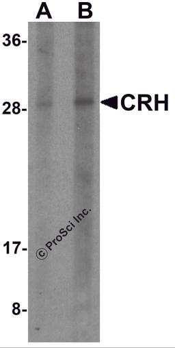 Western blot analysis of CRH in human placenta tissue lysate with CRH antibody at (A) 1 and (B) 2 μg/ml.