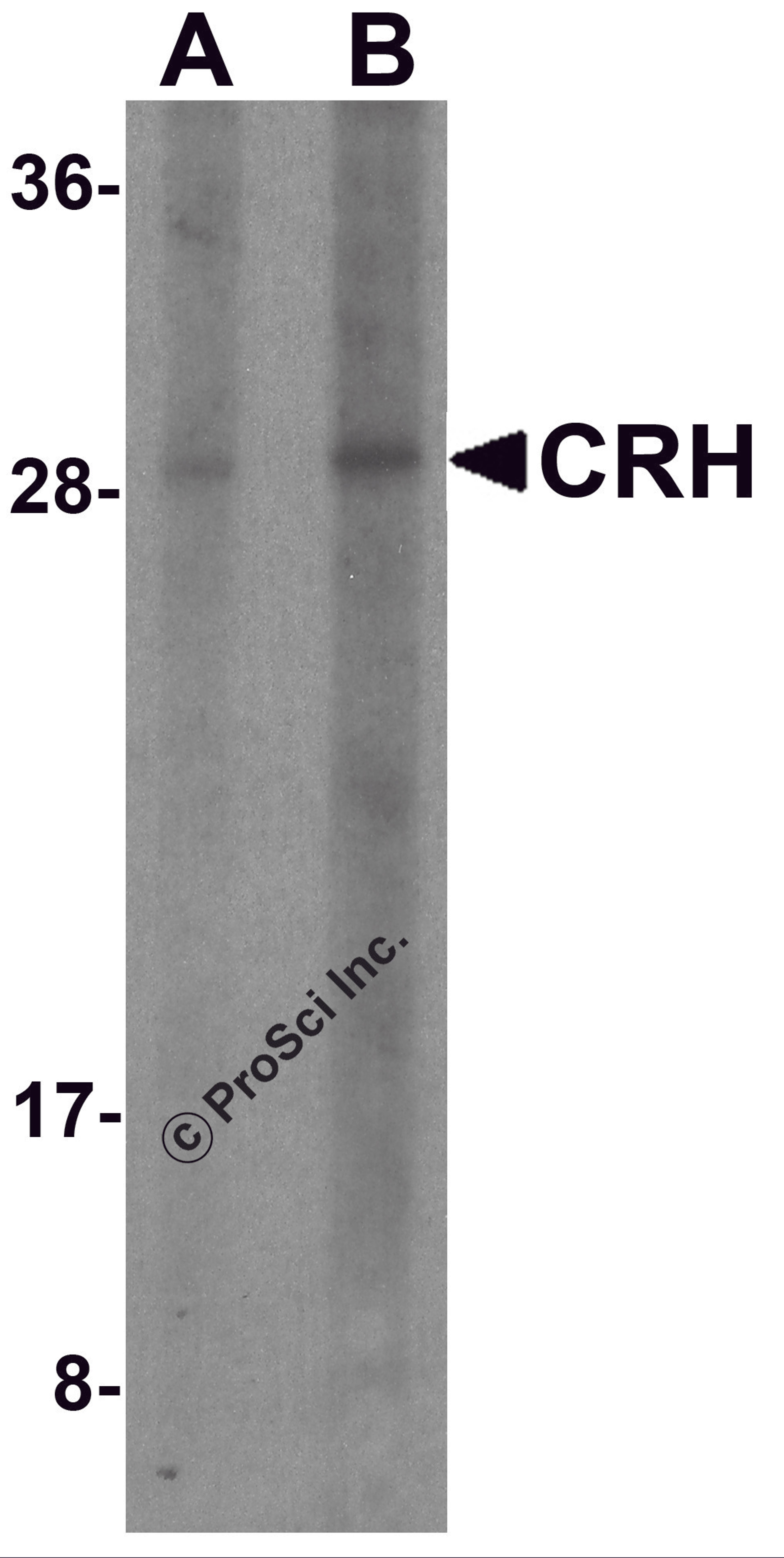 Western blot analysis of CRH in human placenta tissue lysate with CRH antibody at (A) 1 and (B) 2 μg/ml.