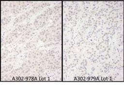 Detection of human DDX56 by immunohistochemistry.