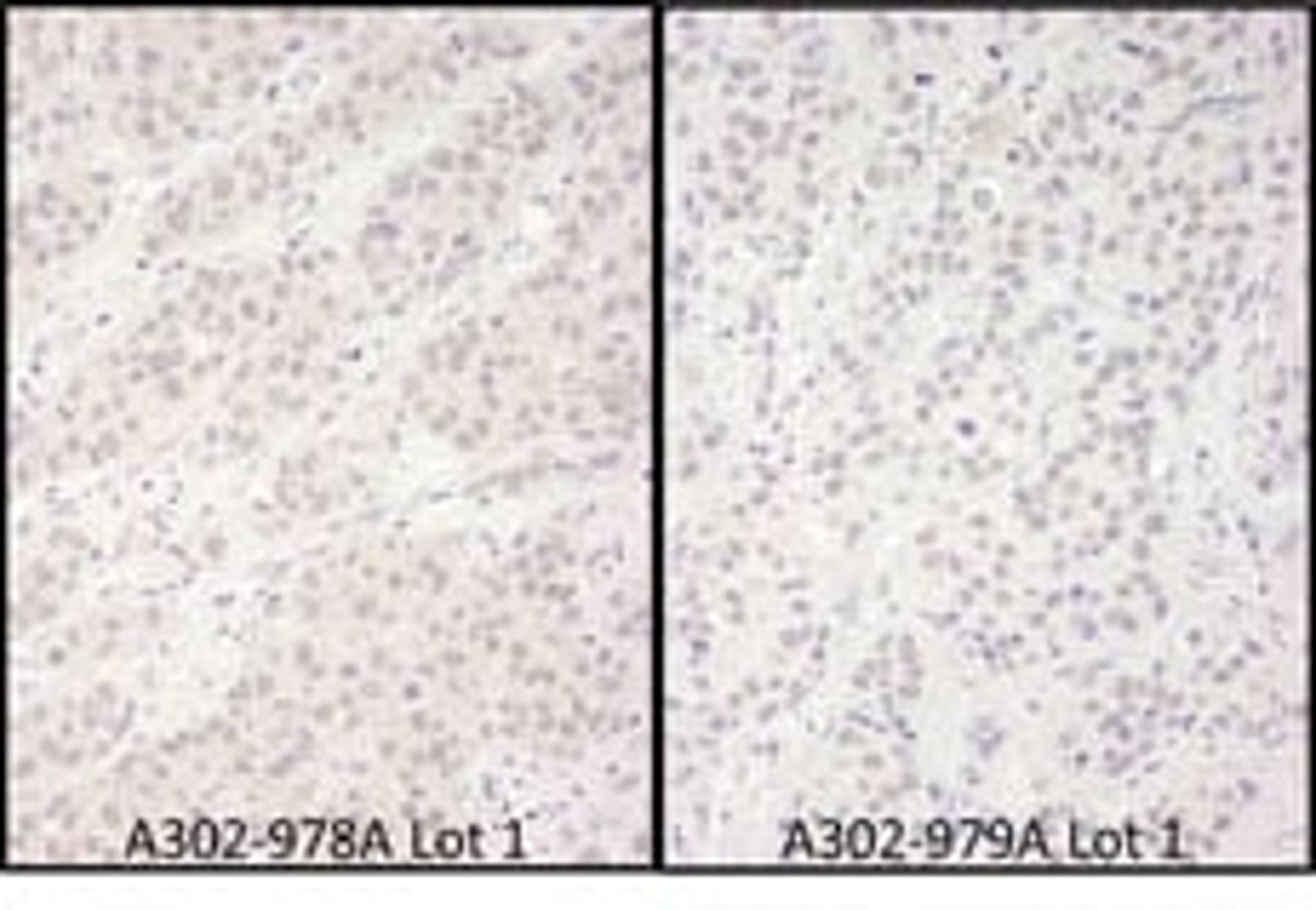 Detection of human DDX56 by immunohistochemistry.