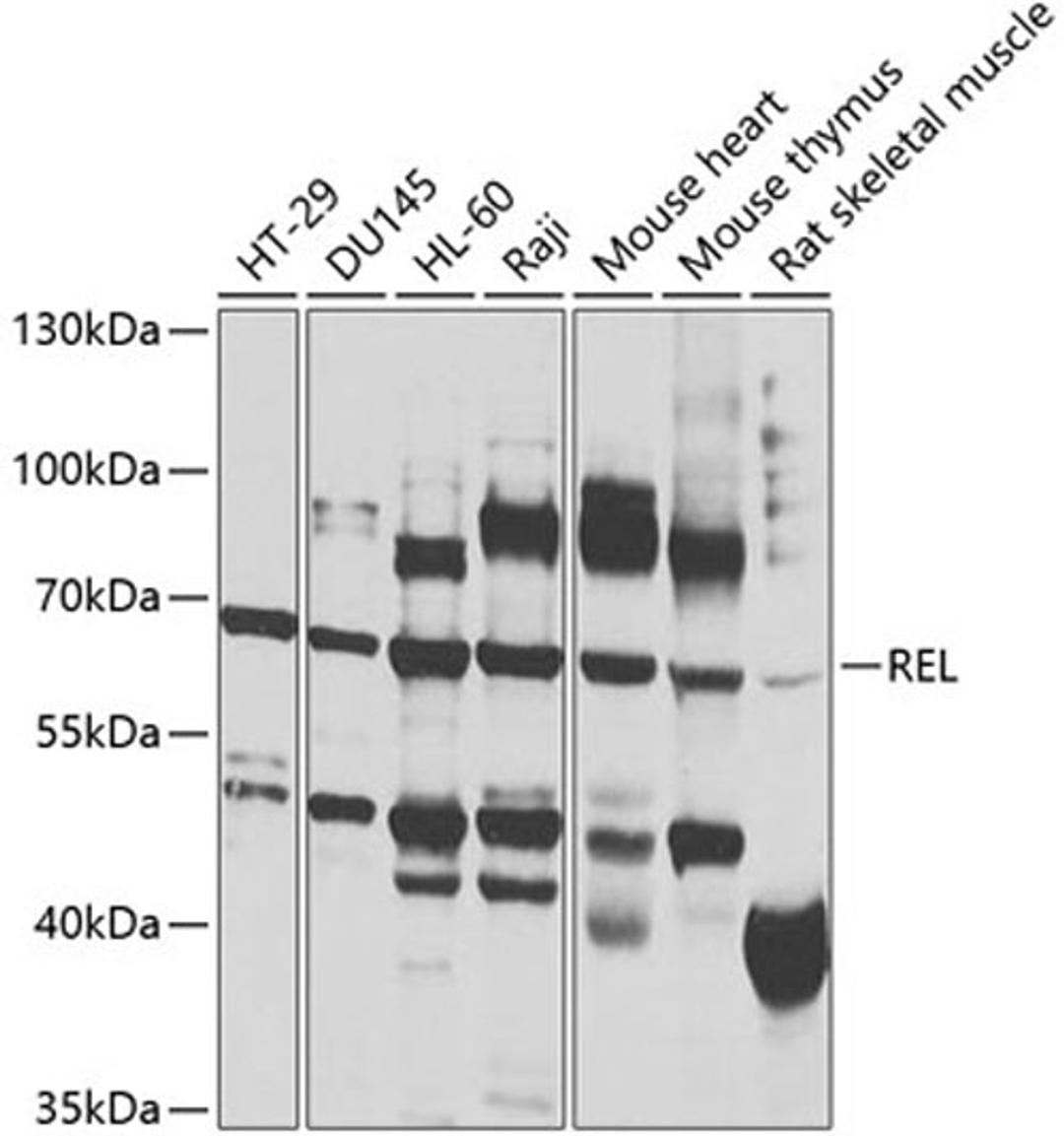 Western blot - REL antibody (A1181)