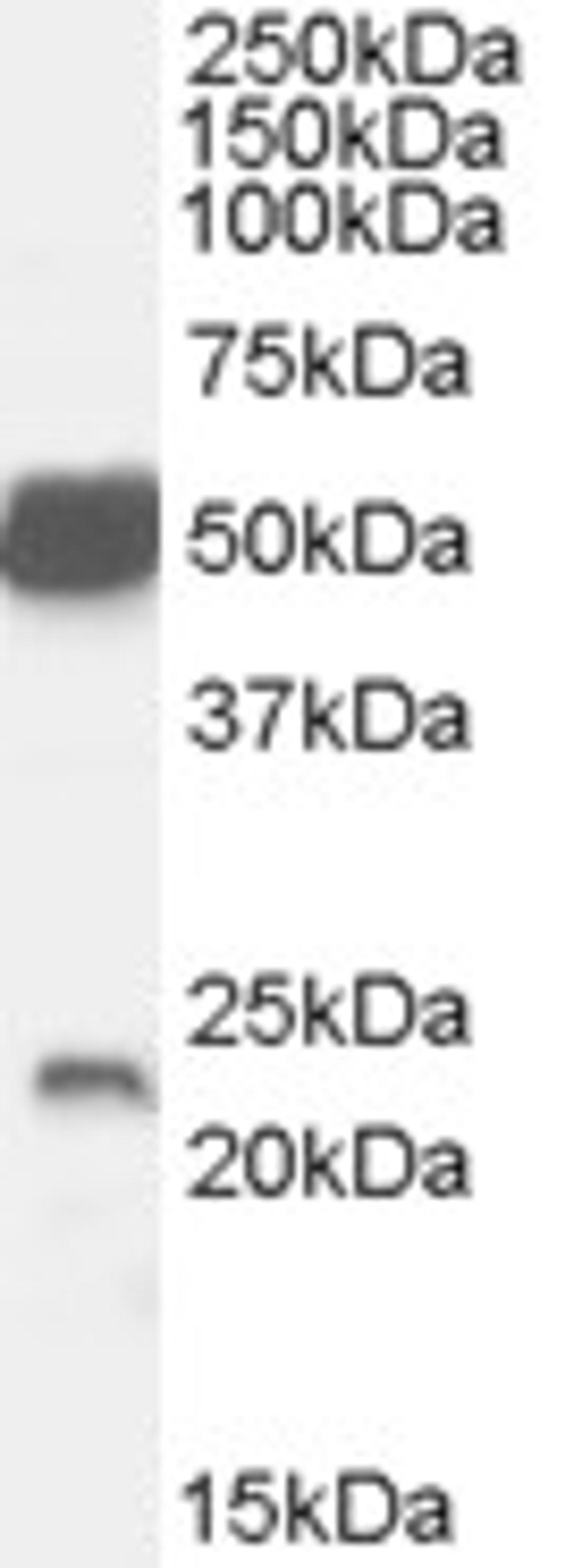 45-963 (0.1ug/ml) staining of Mouse Brain lysate (35ug protein in RIPA buffer). Primary incubation was 1 hour. Detected by chemiluminescence.