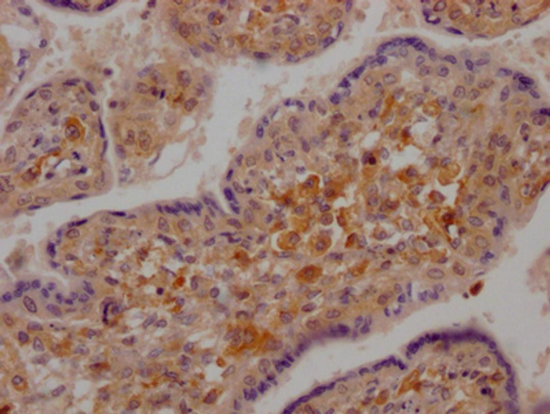 IHC image of CSB-RA207378A0HU diluted at 1:100 and staining in paraffin-embedded human placenta tissue performed on a Leica BondTM system. After dewaxing and hydration, antigen retrieval was mediated by high pressure in a citrate buffer (pH 6.0). Section was blocked with 10% normal goat serum 30min at RT. Then primary antibody (1% BSA) was incubated at 4℃ overnight. The primary is detected by a Goat anti-rabbit IgG polymer labeled by HRP and visualized using 0.05% DAB.