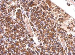 Immunohistochemistry-Paraffin: MDH2 Antibody [NBP1-32259] - Paraffin-embedded OVCA xenograft.