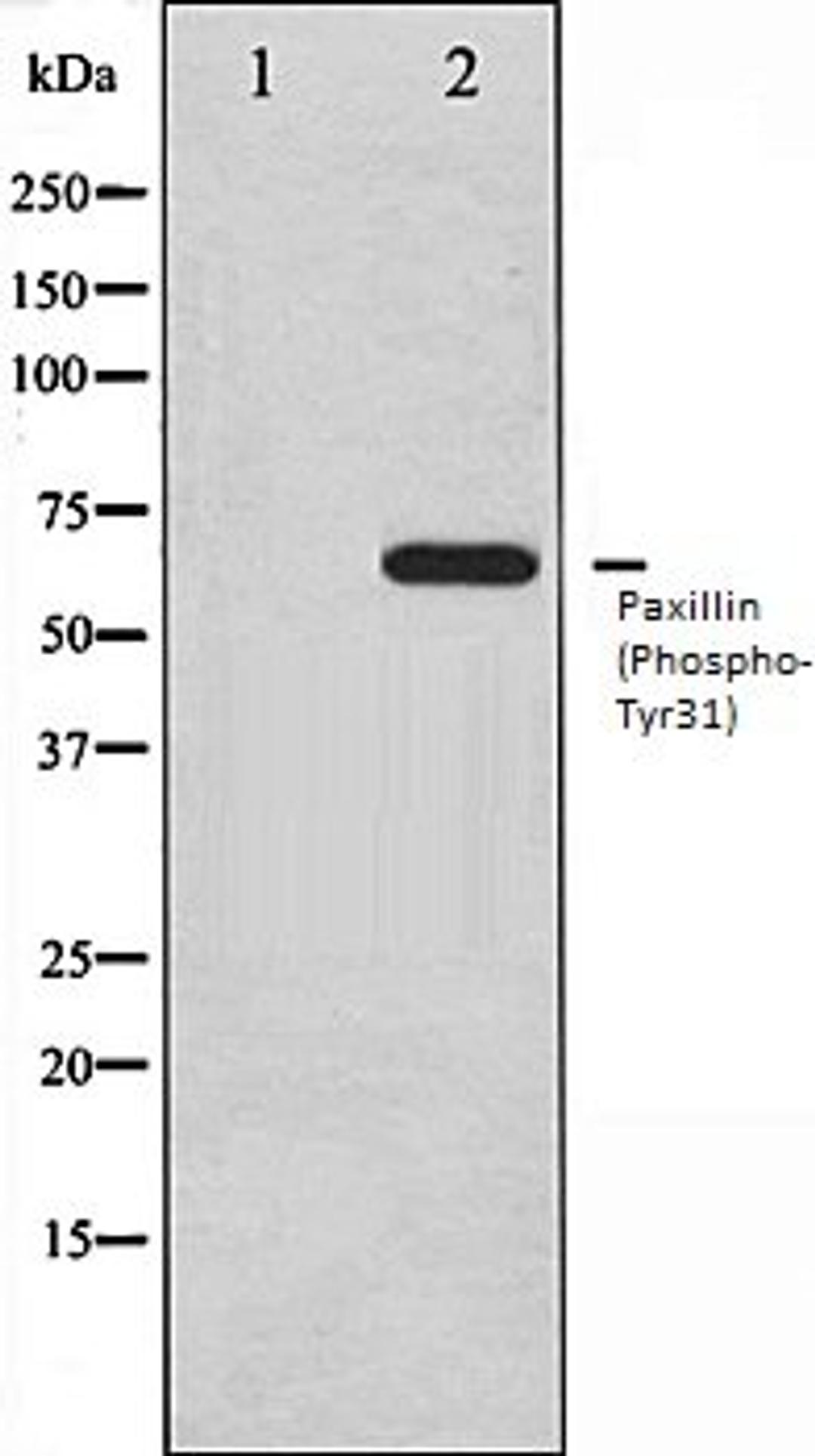 Western blot analysis of SK-OV3 whole cell lysates using Paxillin (Phospho-Tyr31) antibody, The lane on the left is treated with the antigen-specific peptide.