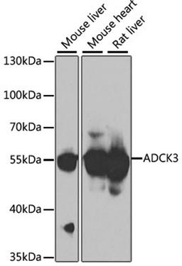 Western blot - ADCK3 antibody (A7378)