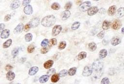 Detection of human ZHX3 by immunohistochemistry.