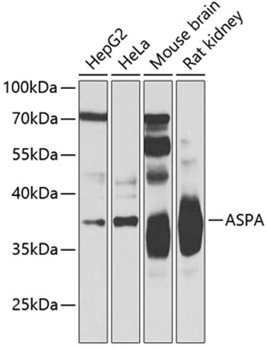 Western blot - ASPA Antibody (A7271)