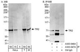 Detection of human and mouse TR2 by western blot (h&m) and immunoprecipitation (h).