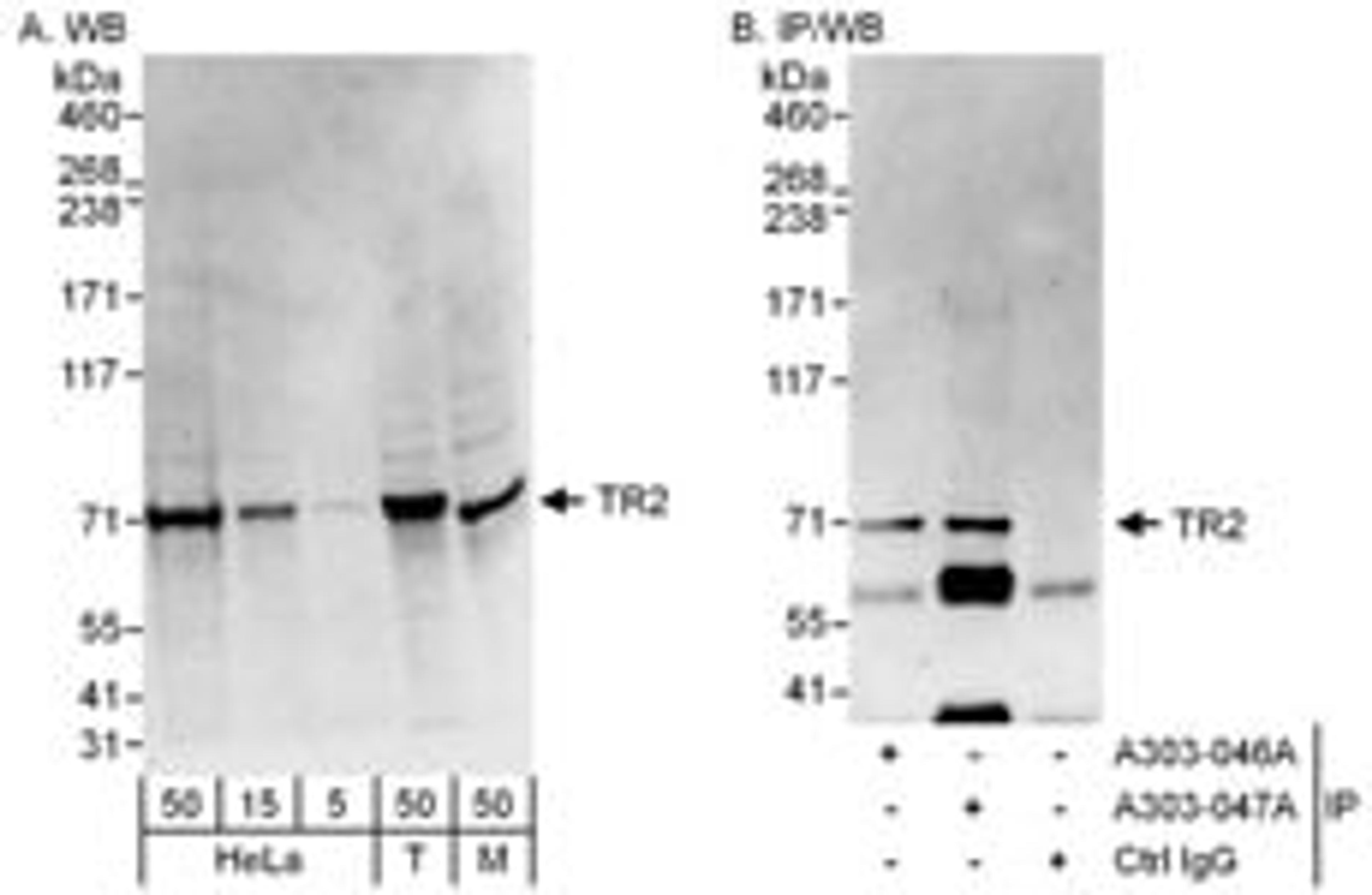 Detection of human and mouse TR2 by western blot (h&m) and immunoprecipitation (h).