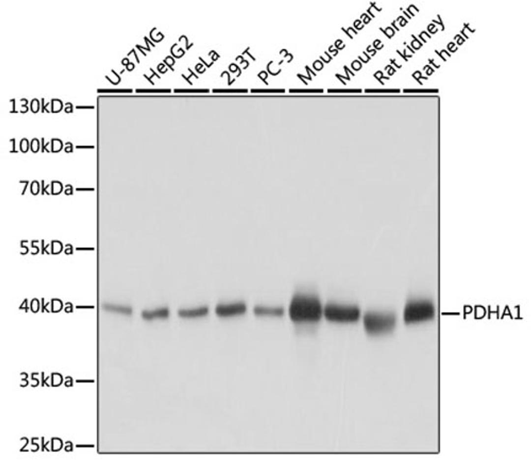 Western blot - PDHA1 antibody (A17432)