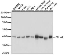 Western blot - PDHA1 antibody (A17432)