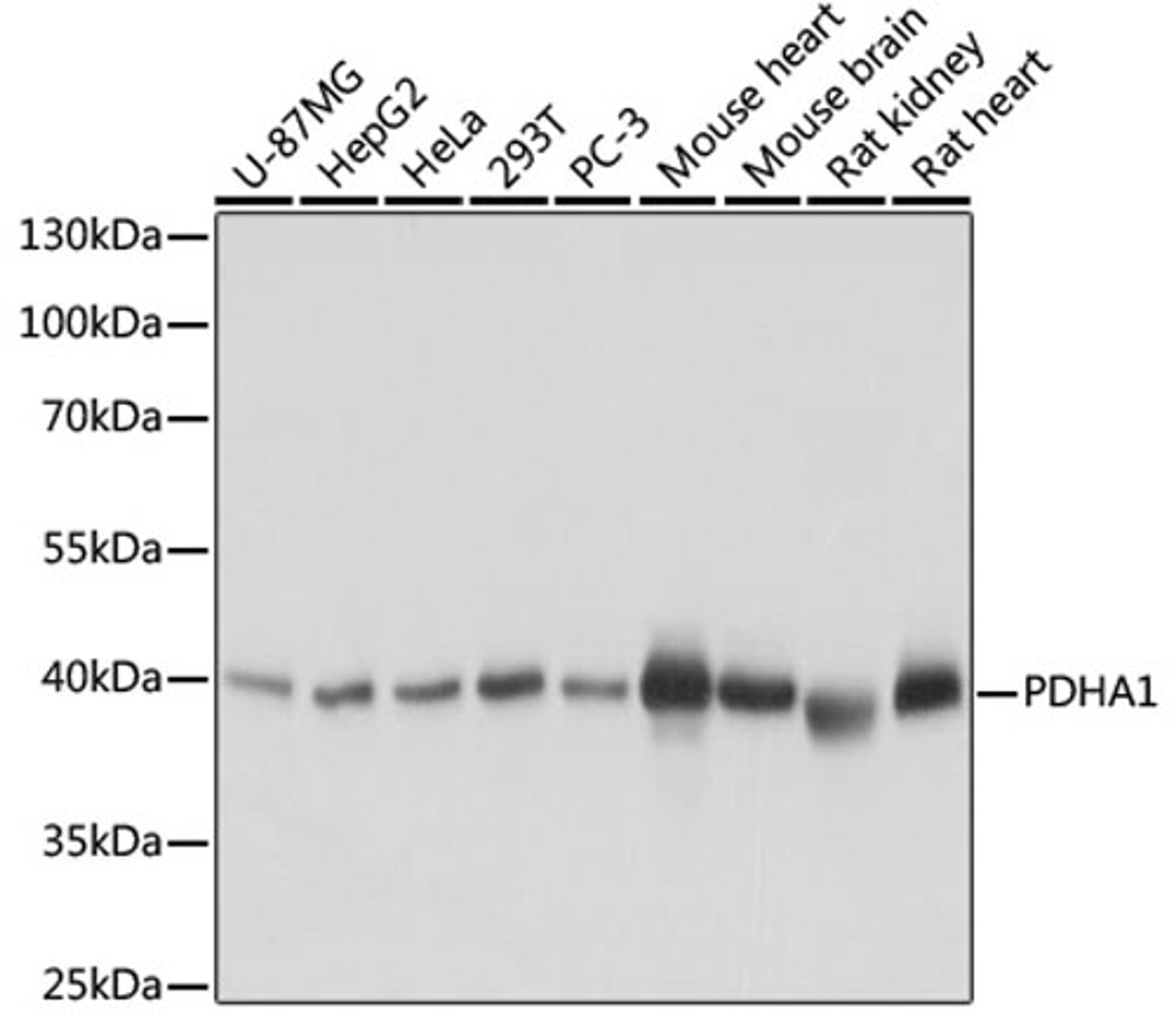 Western blot - PDHA1 antibody (A17432)