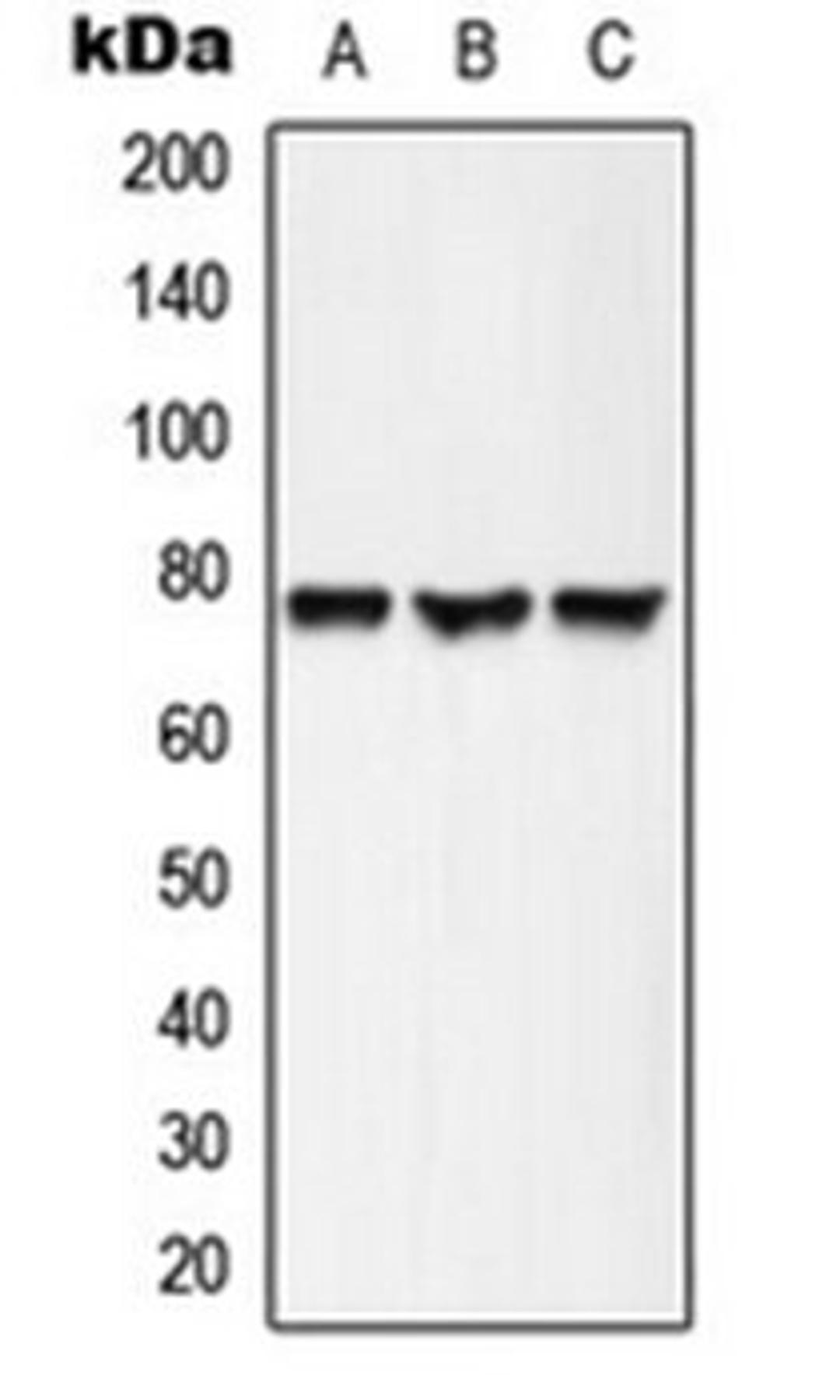 Western blot analysis of HepG2 (Lane 1), mouse brain (Lane 2), rat brain (Lane 3) whole cell lysates using ACSL6 antibody