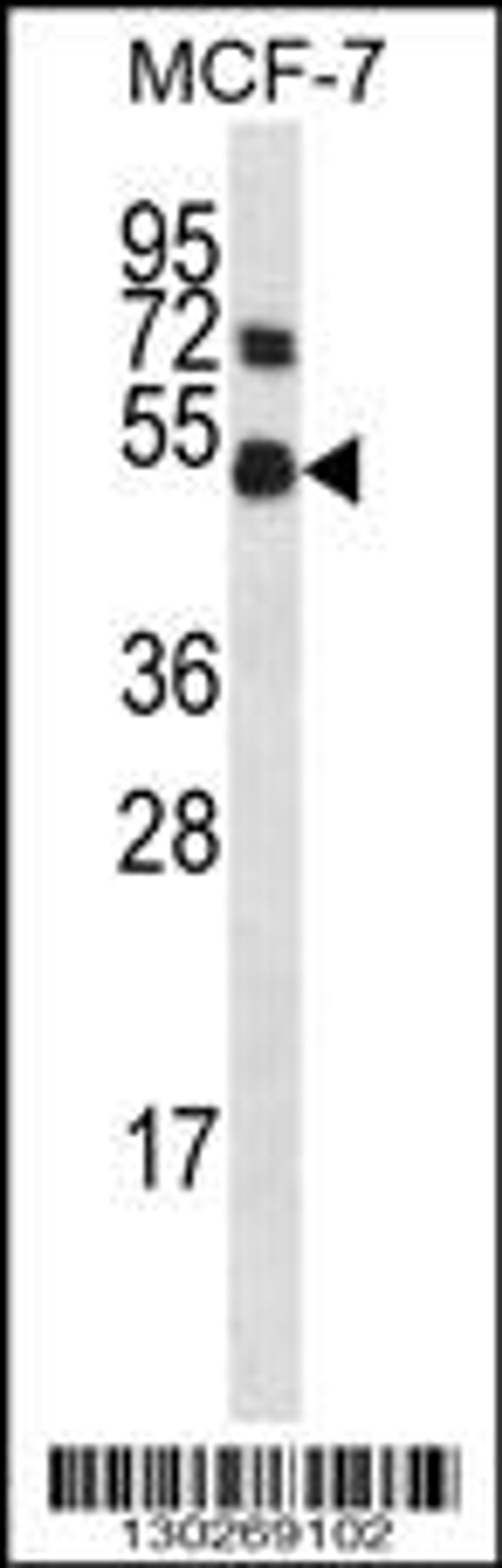 Western blot analysis in MCF-7 cell line lysates (35ug/lane).