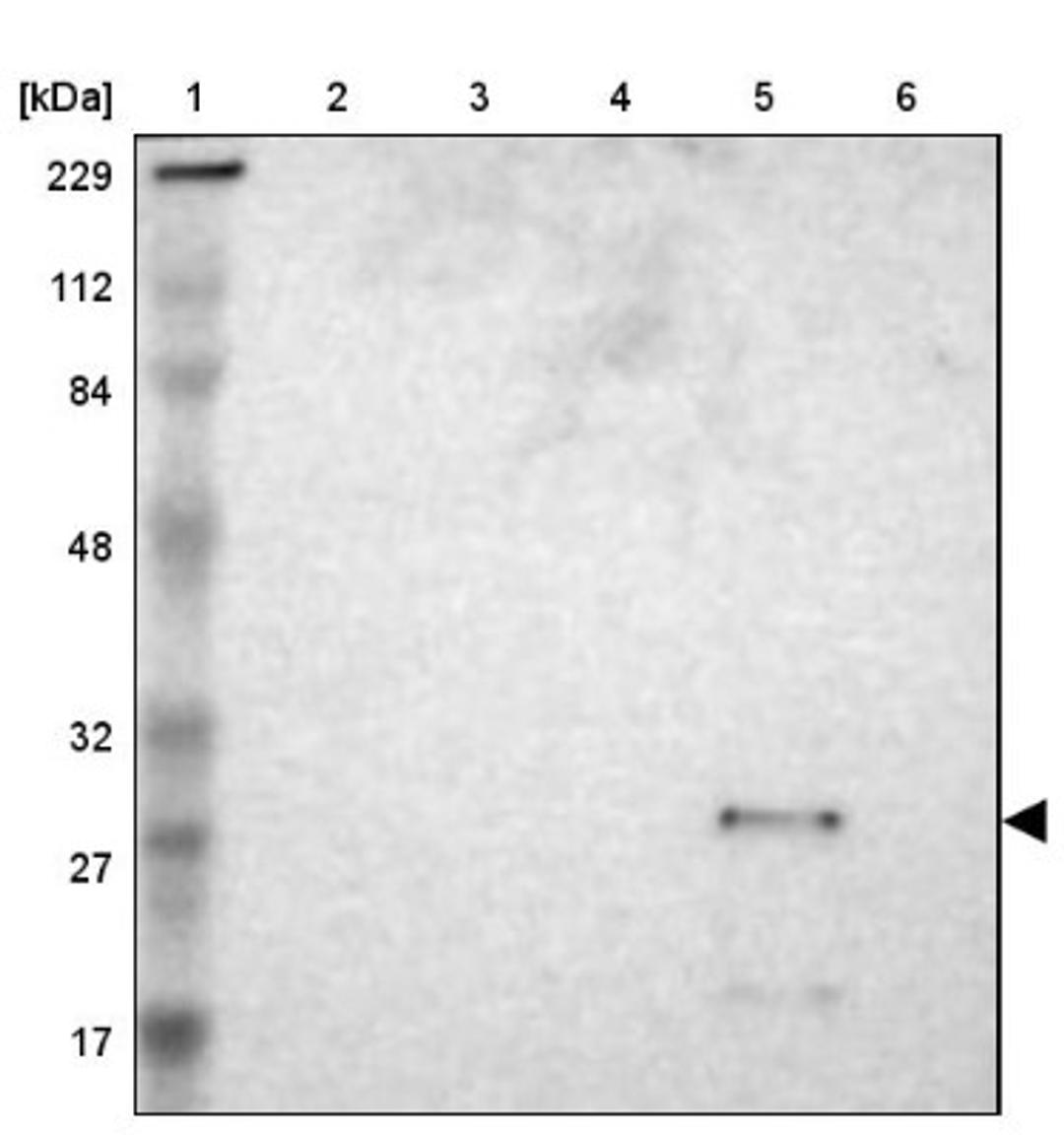 Western Blot: ASB6 Antibody [NBP1-86141] - Lane 1: Marker [kDa] 229, 112, 84, 48, 32, 27, 17<br/>Lane 2: Human cell line RT-4<br/>Lane 3: Human cell line U-251MG sp<br/>Lane 4: Human plasma (IgG/HSA depleted)<br/>Lane 5: Human liver tissue<br/>Lane 6: Human tonsil tissue