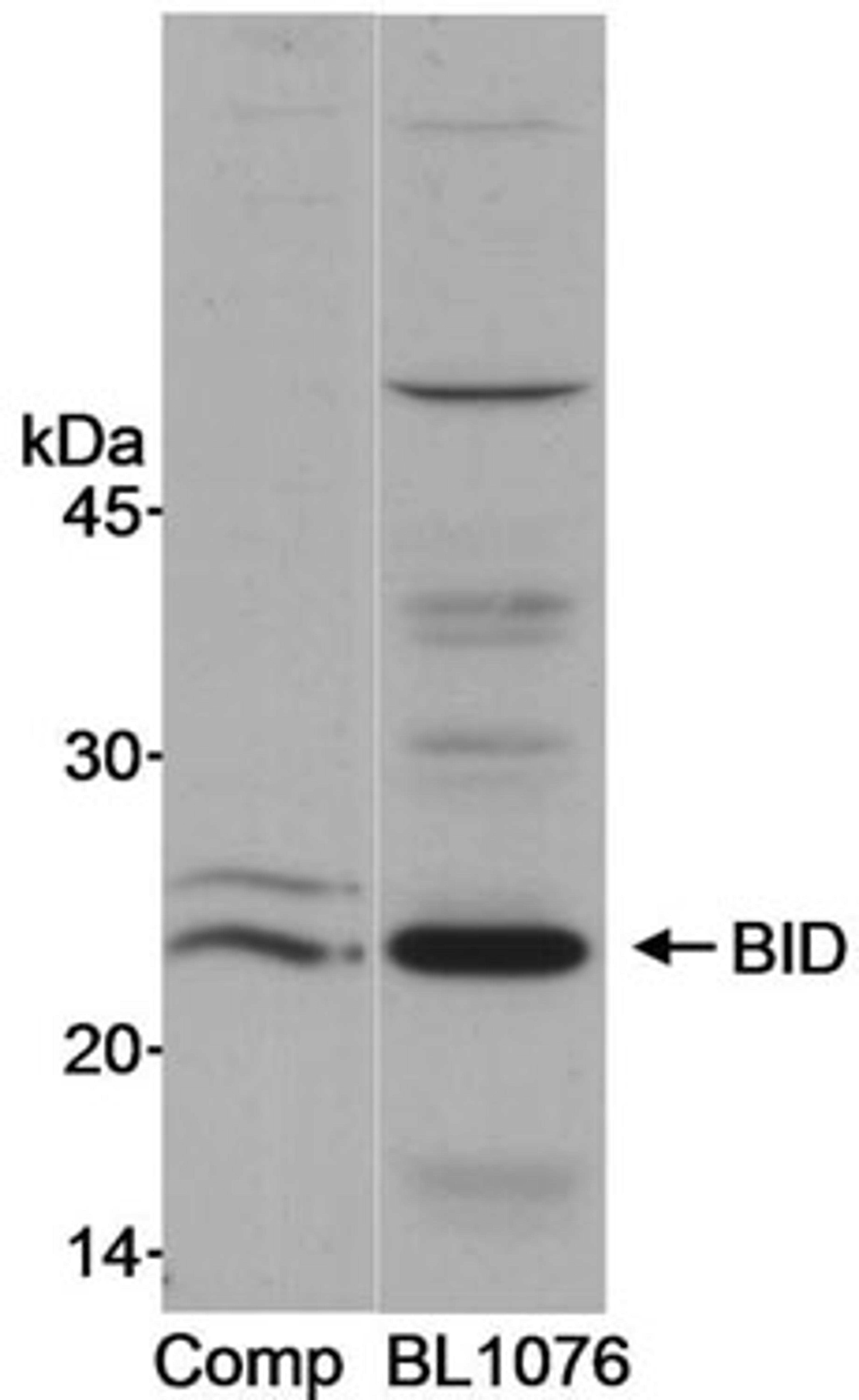 Detection of human BID by western blot.