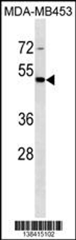 Western blot analysis in MDA-MB453 cell line lysates (35ug/lane).