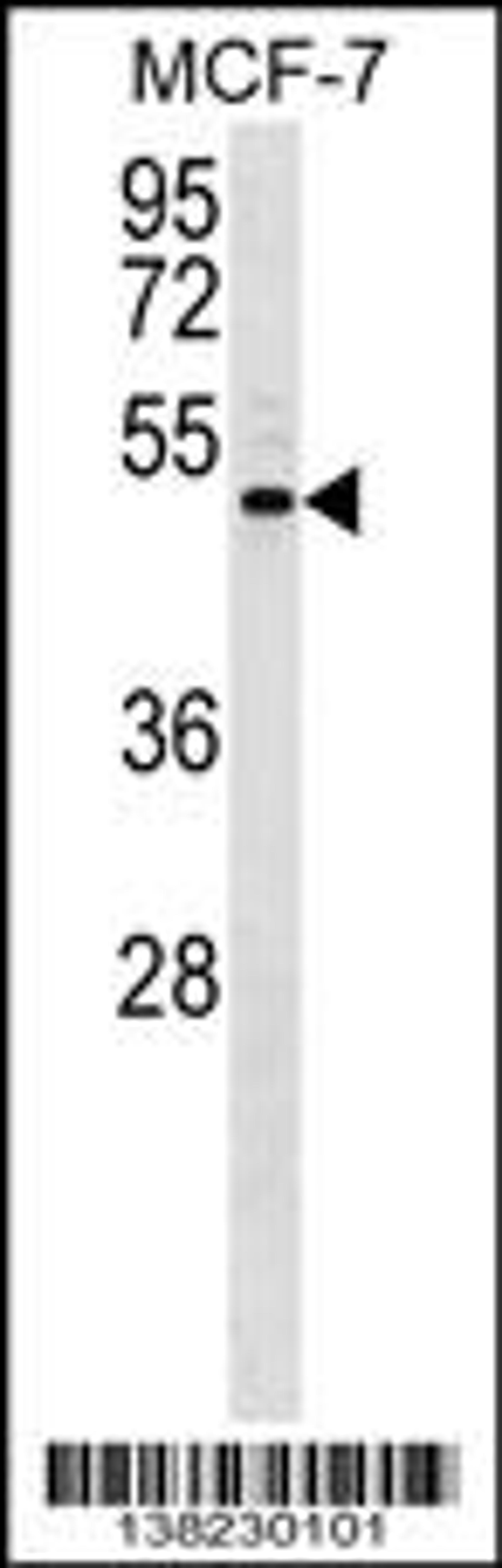 Western blot analysis in MCF-7 cell line lysates (35ug/lane).