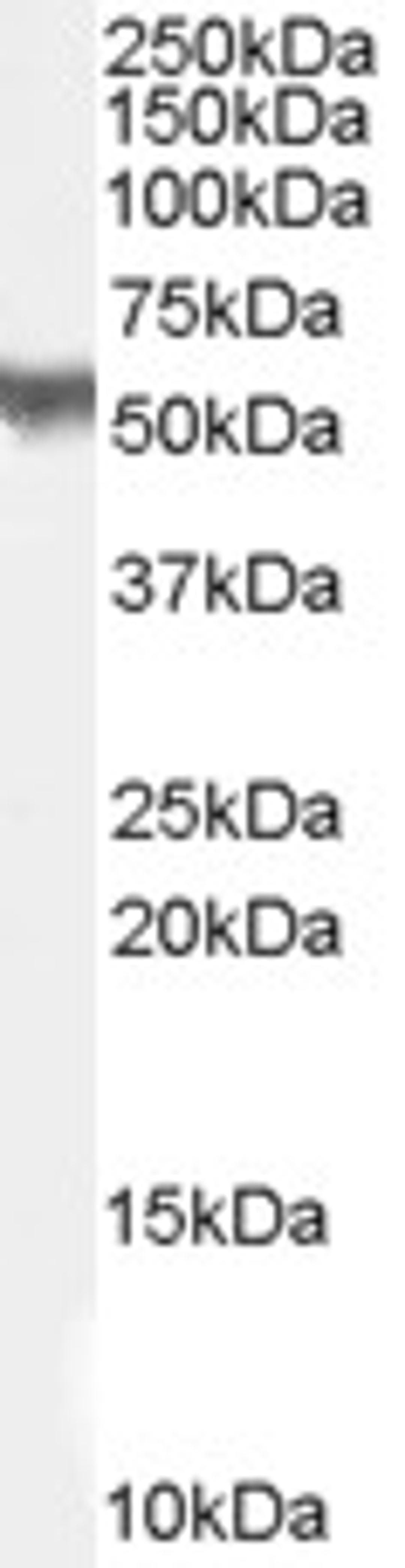 46-125 staining (1ug/ml) of H460 lysate (RIPA buffer, 35ug total protein per lane). Primary incubated for 1 hour. Detected by western blot using chemiluminescence.