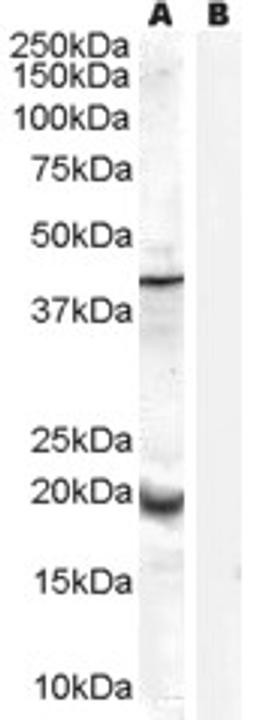 45-702 (0.3ug/ml) staining of Human Prostate lysate (35ug protein in RIPA buffer) with (B) and without (A) blocking with the immunising peptide. Primary incubation was 1 hour. Detected by chemiluminescence.