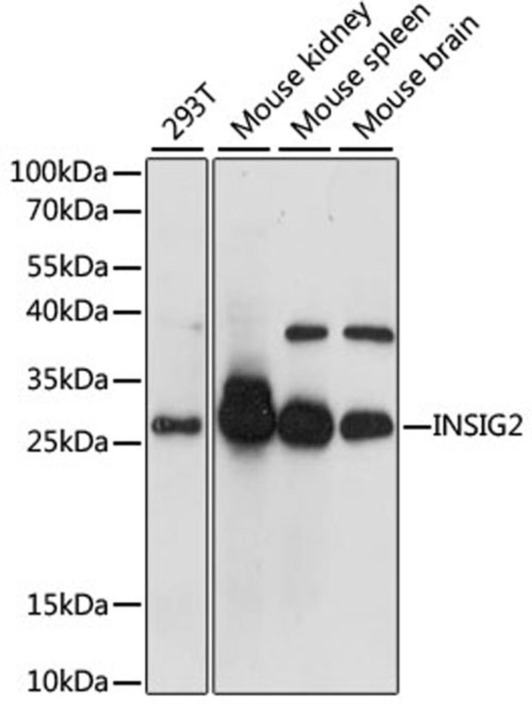 Western blot - INSIG2 antibody (A1992)