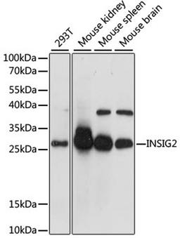 Western blot - INSIG2 antibody (A1992)