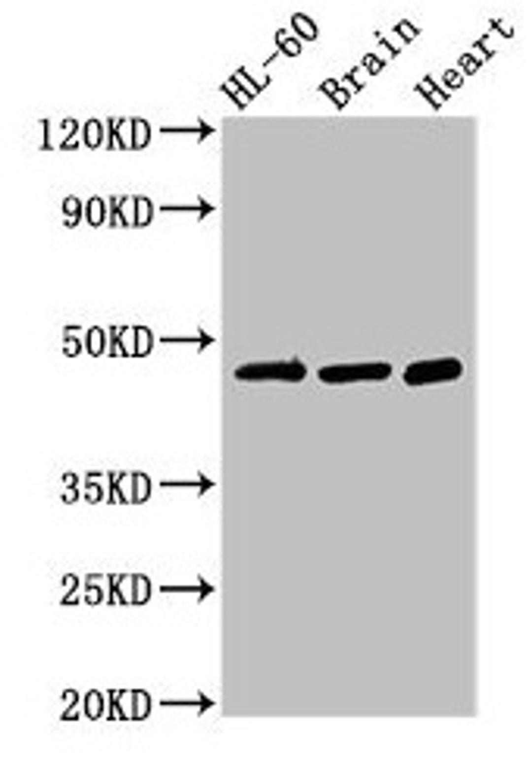 Western Blot. Positive WB detected in: HL60 whole cell lysate, Mouse brain tissue, Rat heart tissue. All lanes: CHST1 antibody at 3µg/ml. Secondary. Goat polyclonal to rabbit IgG at 1/50000 dilution. Predicted band size: 47 kDa. Observed band size: 47 kDa