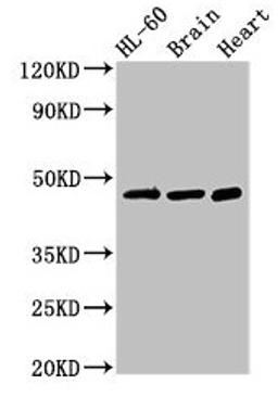 Western Blot. Positive WB detected in: HL60 whole cell lysate, Mouse brain tissue, Rat heart tissue. All lanes: CHST1 antibody at 3µg/ml. Secondary. Goat polyclonal to rabbit IgG at 1/50000 dilution. Predicted band size: 47 kDa. Observed band size: 47 kDa