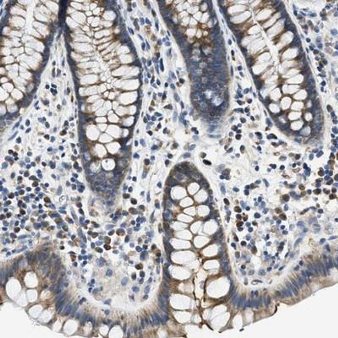 Immunohistochemistry-Paraffin: Carbonic Anhydrase IV/CA4 Antibody [NBP1-88225] - Immunohistochemical staining of human colon shows moderate cytoplasmic and occasional membranous positivity in glandular cells.