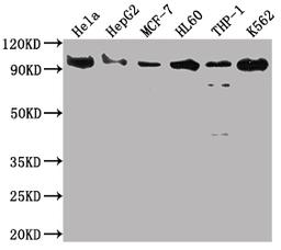 Western Blot. Positive WB detected in: Hela whole cell lysate, HepG2 whole cell lysate, MCF-7 whole cell lysate, HL60 whole cell lysate, THP-1 whole cell lysate, K562 whole cell lysate. All lanes: SUZ12 antibody at 1:2000. Secondary. Goat polyclonal to rabbit IgG at 1/50000 dilution. Predicted band size: 84 kDa. Observed band size: 90 kDa. 