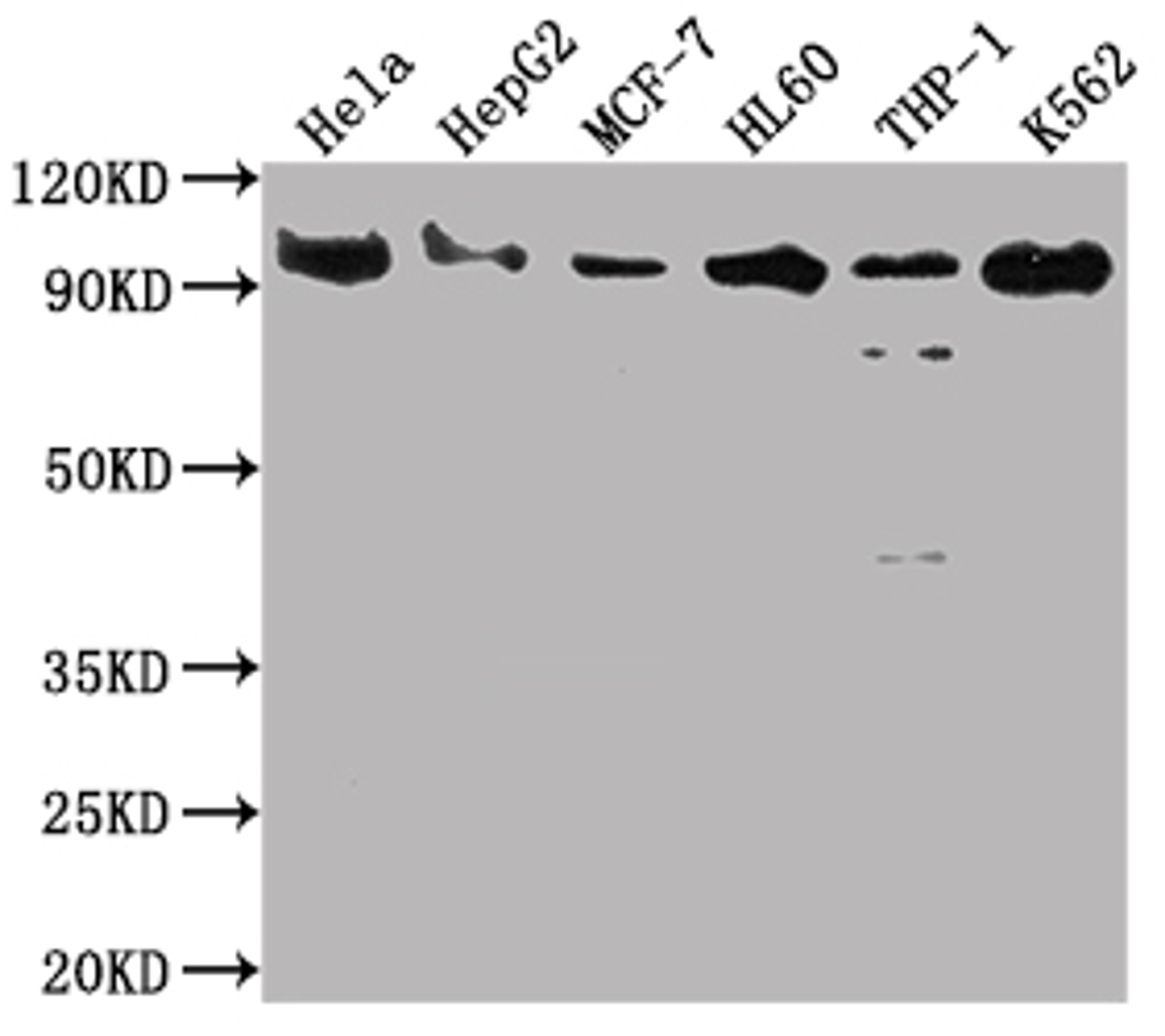 Western Blot. Positive WB detected in: Hela whole cell lysate, HepG2 whole cell lysate, MCF-7 whole cell lysate, HL60 whole cell lysate, THP-1 whole cell lysate, K562 whole cell lysate. All lanes: SUZ12 antibody at 1:2000. Secondary. Goat polyclonal to rabbit IgG at 1/50000 dilution. Predicted band size: 84 kDa. Observed band size: 90 kDa. 
