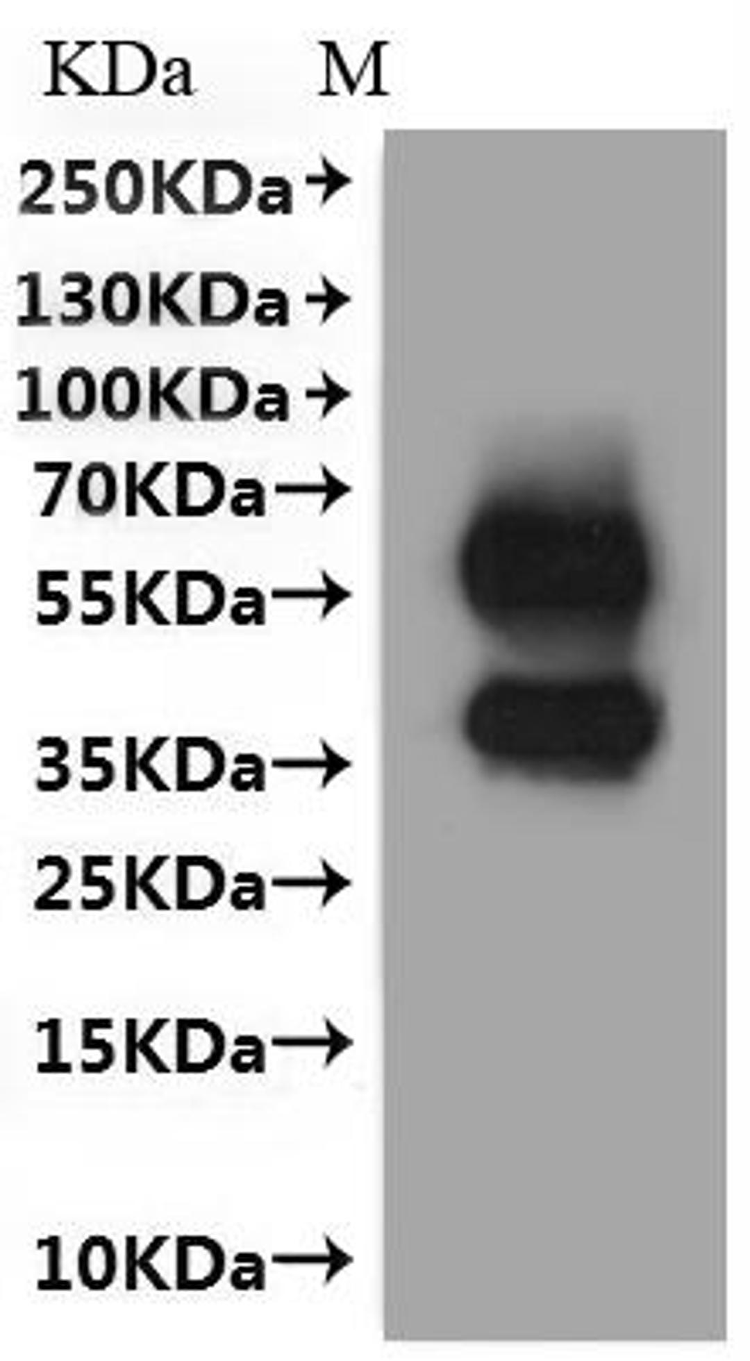 CSB-MP5193RA is detected by Mouse anti-6*His monoclonal antibody.