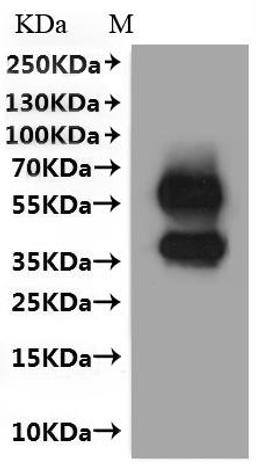 CSB-MP5193RA is detected by Mouse anti-6*His monoclonal antibody.
