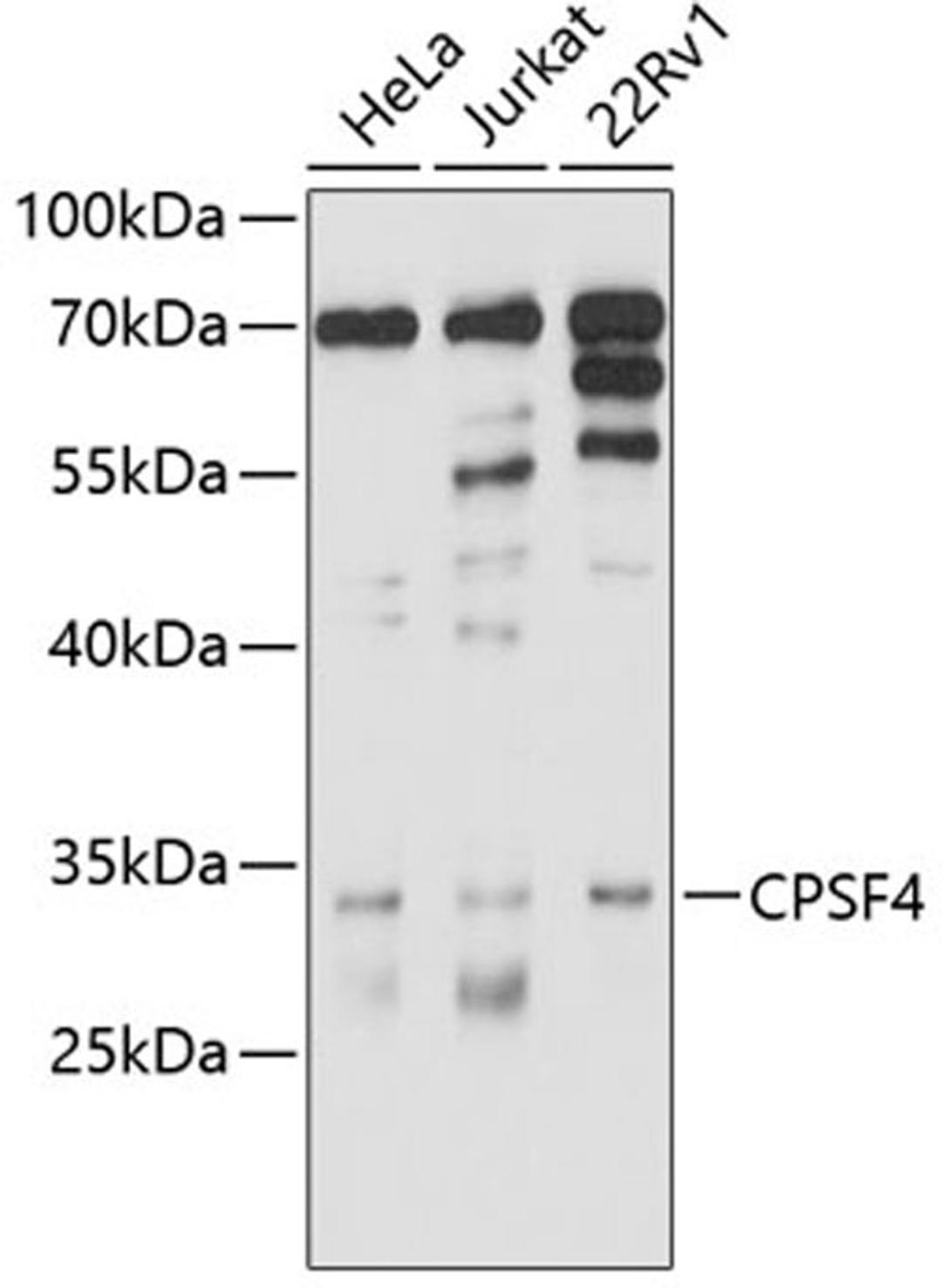 Western blot - CPSF4 antibody (A10284)