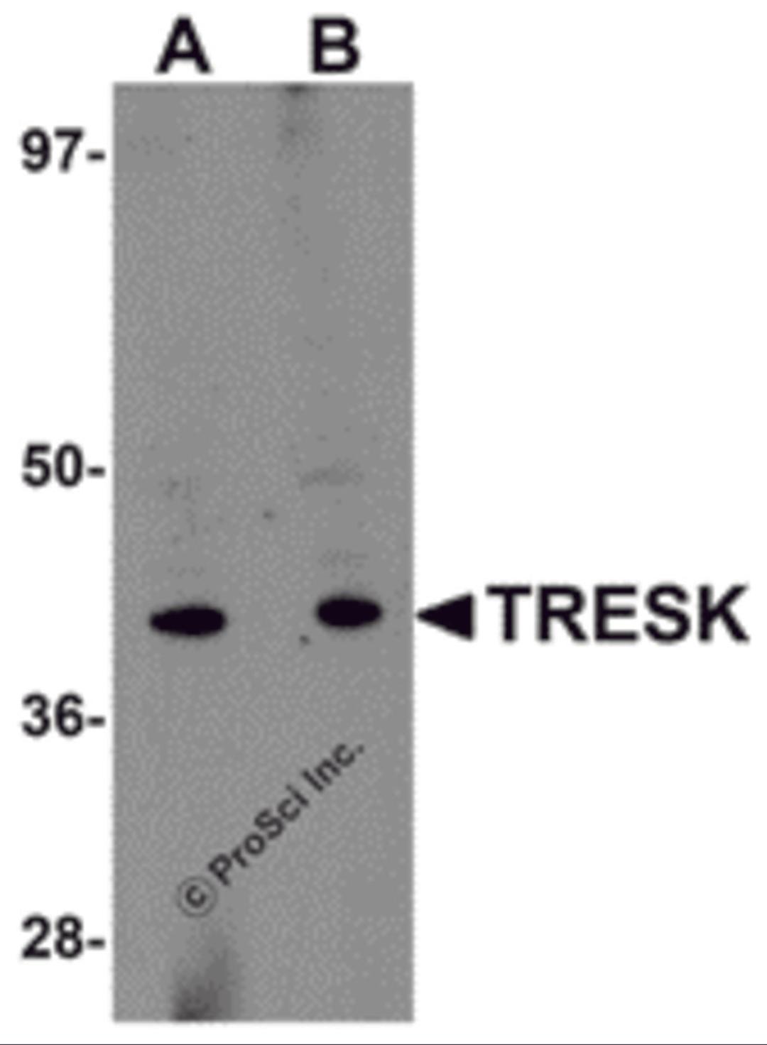 Western blot analysis of TRESK in rat brain tissue lysate with TRESK antibody at (A) 1 and (B) 2 &#956;g/mL.