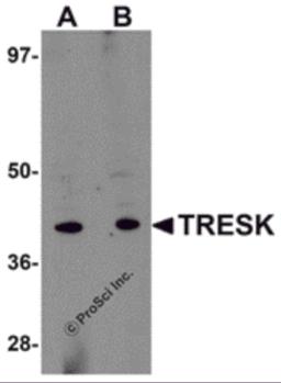 Western blot analysis of TRESK in rat brain tissue lysate with TRESK antibody at (A) 1 and (B) 2 &#956;g/mL.