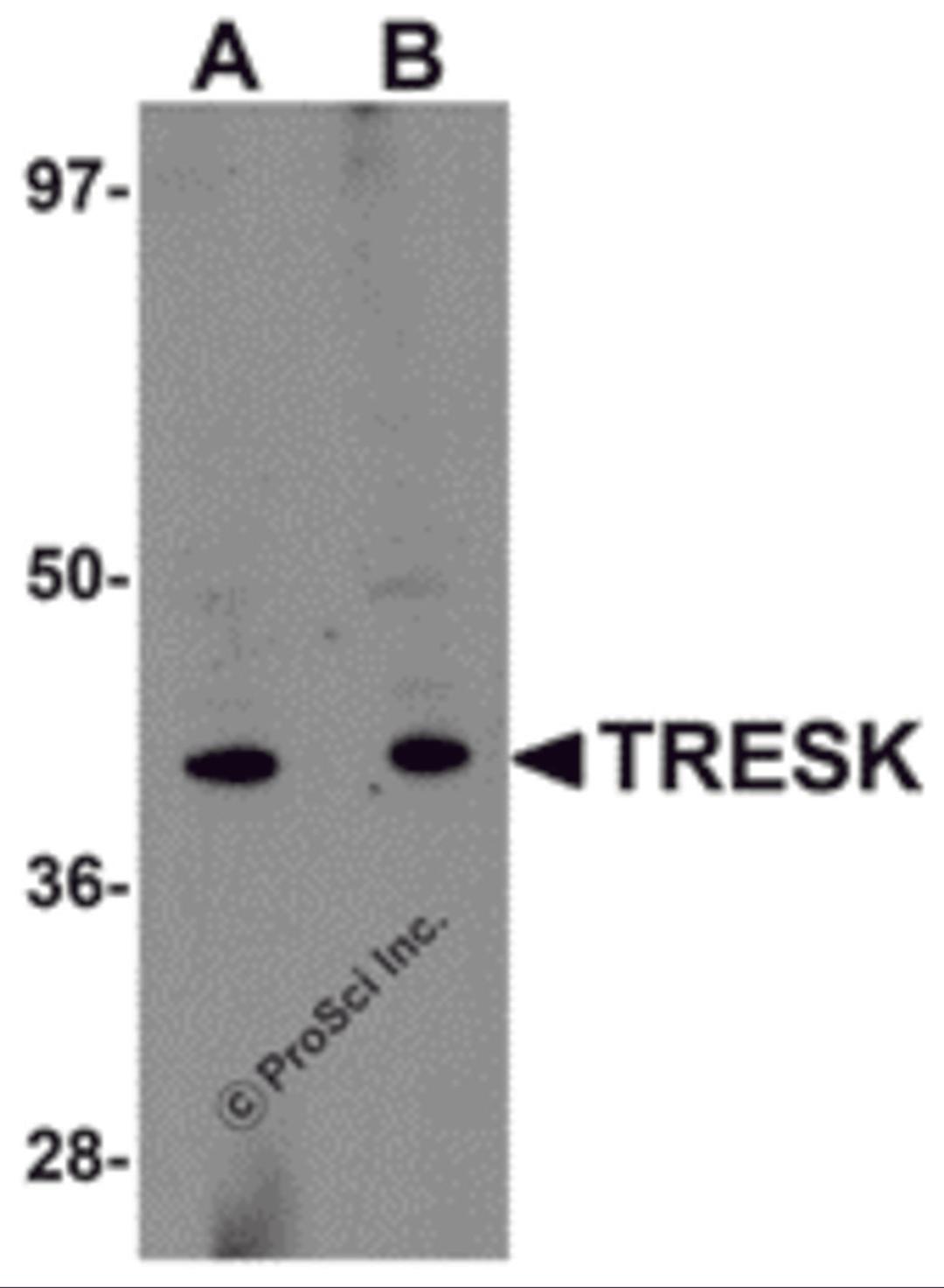 Western blot analysis of TRESK in rat brain tissue lysate with TRESK antibody at (A) 1 and (B) 2 μg/mL.