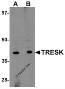 Western blot analysis of TRESK in rat brain tissue lysate with TRESK antibody at (A) 1 and (B) 2 μg/mL.