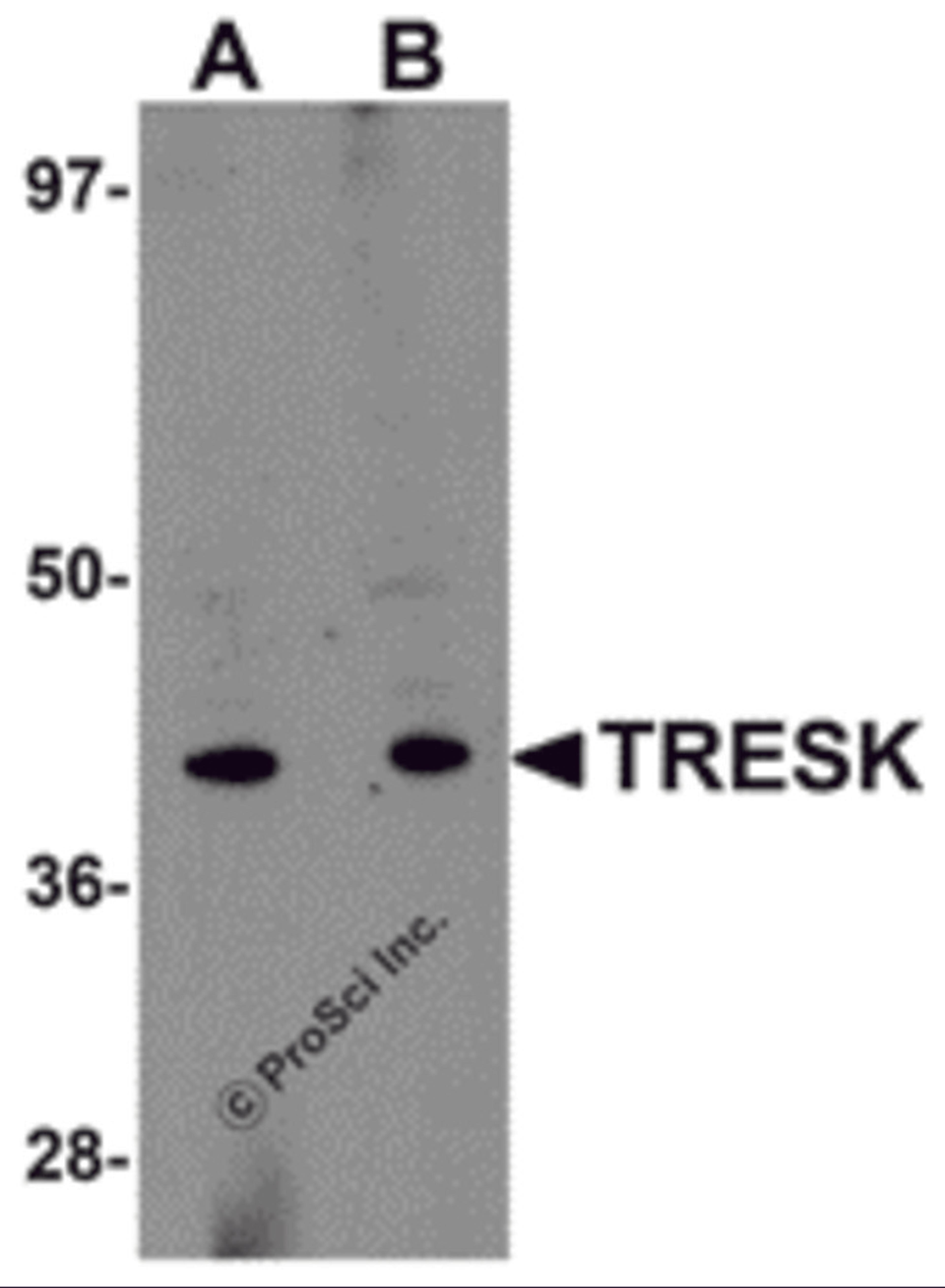 Western blot analysis of TRESK in rat brain tissue lysate with TRESK antibody at (A) 1 and (B) 2 μg/mL.