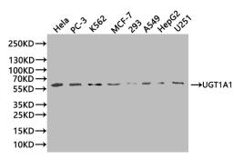 Western Blot. Positive WB detected in: SH-SY5Y whole cell lysate, LO2 whole cell lysate, 293T whole cell lysate, HL-60 whole cell lysate. All lanes: UGT1A1 antibody at 1:2000. Secondary. Goat polyclonal to rabbit IgG at 1/50000 dilution. Predicted band size: 60, 50 kDa. Observed band size: 60 kDa. 
