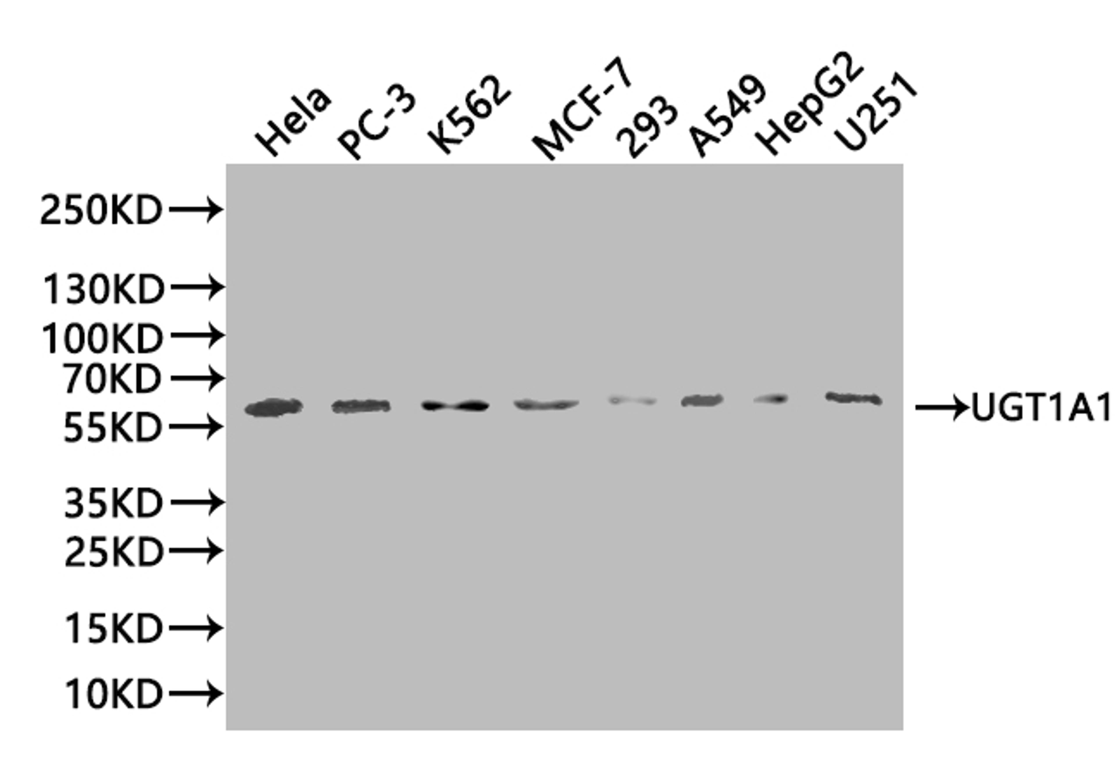 Western Blot. Positive WB detected in: SH-SY5Y whole cell lysate, LO2 whole cell lysate, 293T whole cell lysate, HL-60 whole cell lysate. All lanes: UGT1A1 antibody at 1:2000. Secondary. Goat polyclonal to rabbit IgG at 1/50000 dilution. Predicted band size: 60, 50 kDa. Observed band size: 60 kDa. 