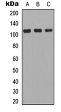 Western blot analysis of A549 (Lane 1), MCF7 (Lane 2), PC12 (Lane 3) whole cell lysates using Apolipoprotein B Receptor antibody