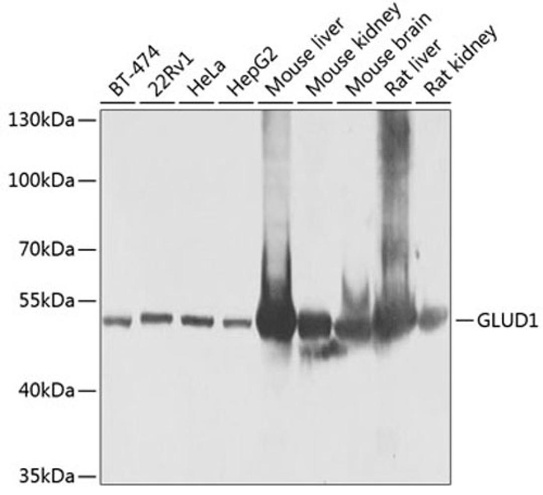 Western blot - GLUD1 antibody (A7631)