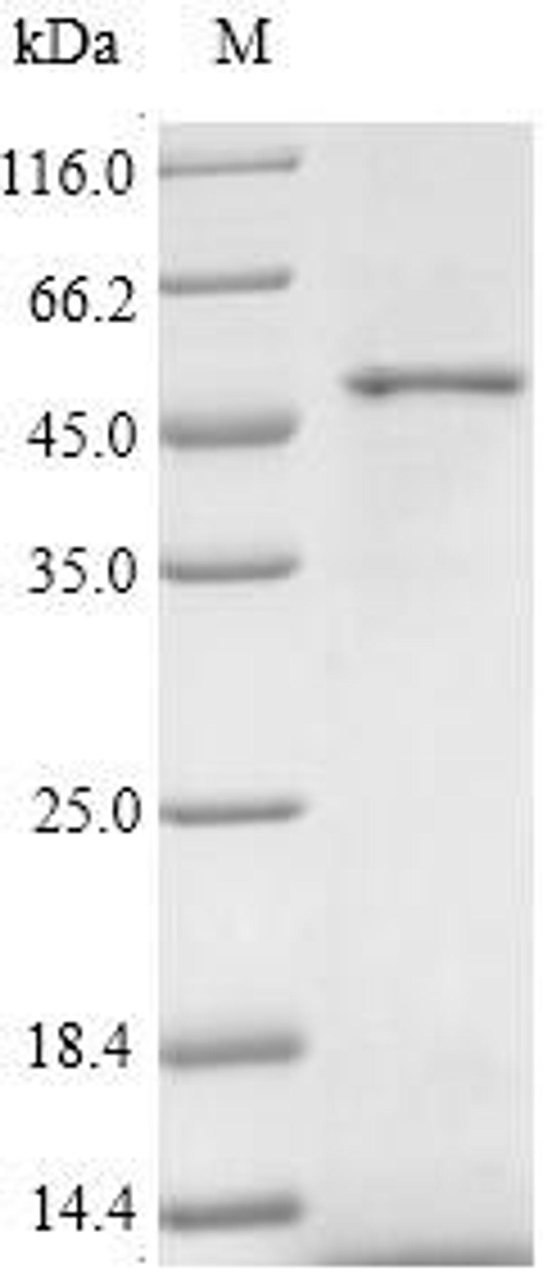 (Tris-Glycine gel) Discontinuous SDS-PAGE (reduced) with 5% enrichment gel and 15% separation gel.
