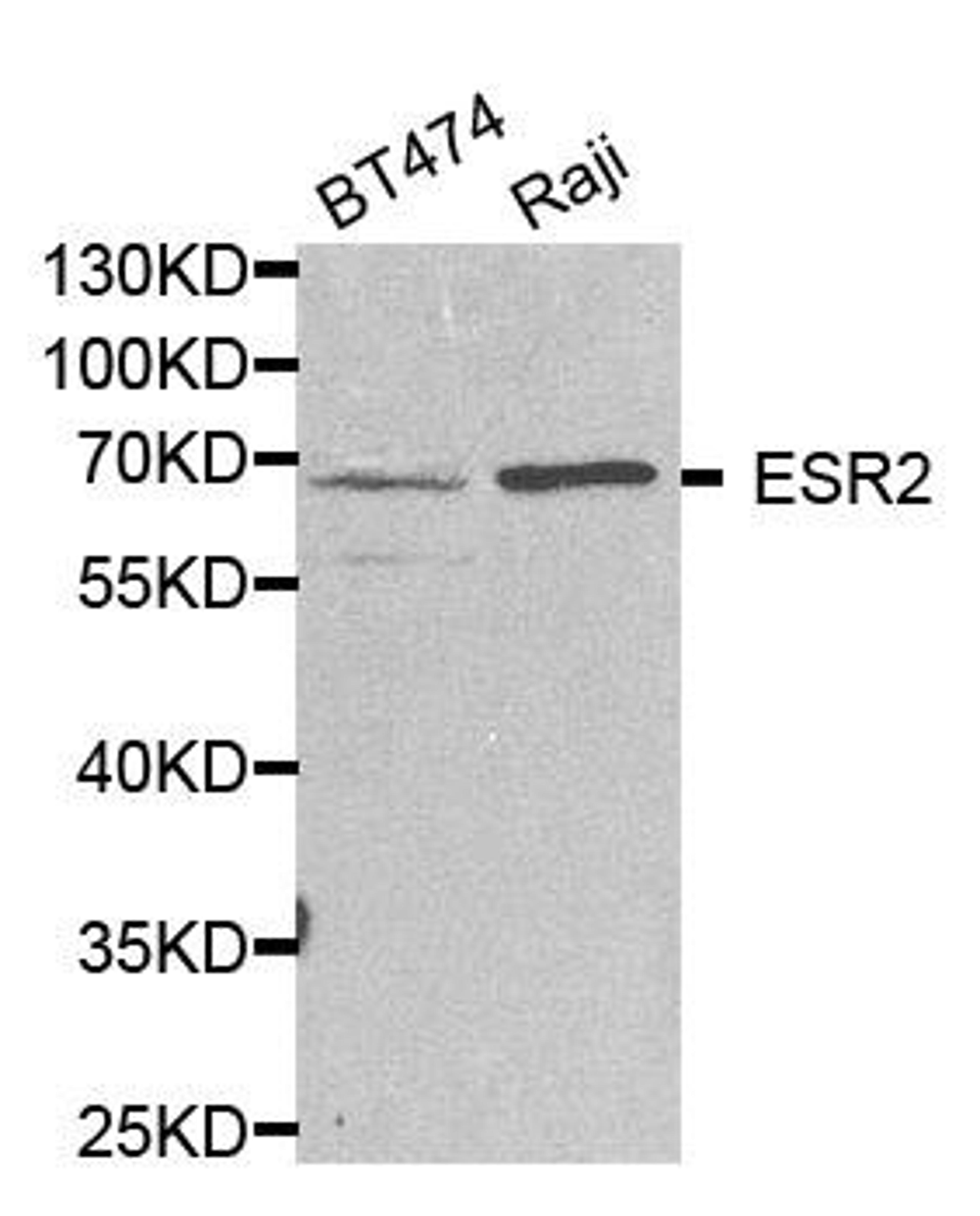 Western blot analysis of extracts of various cell lines using Estrogen Receptor beta 2 antibody