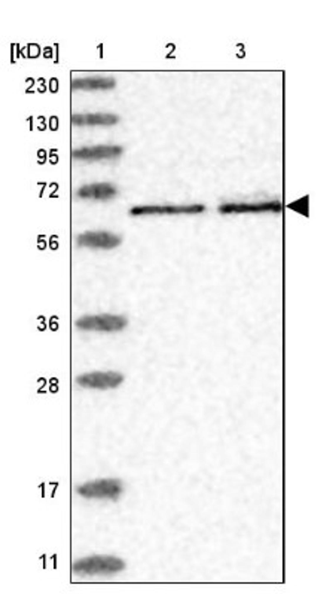 Western Blot: REPIN1 Antibody [NBP1-89059] - Lane 1: Marker [kDa] 230, 130, 95, 72, 56, 36, 28, 17, 11<br/>Lane 2: Human cell line RT-4<br/>Lane 3: Human cell line U-251MG sp