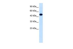 Antibody used in WB on Human Jurkat 0.2-1 ug/ml.