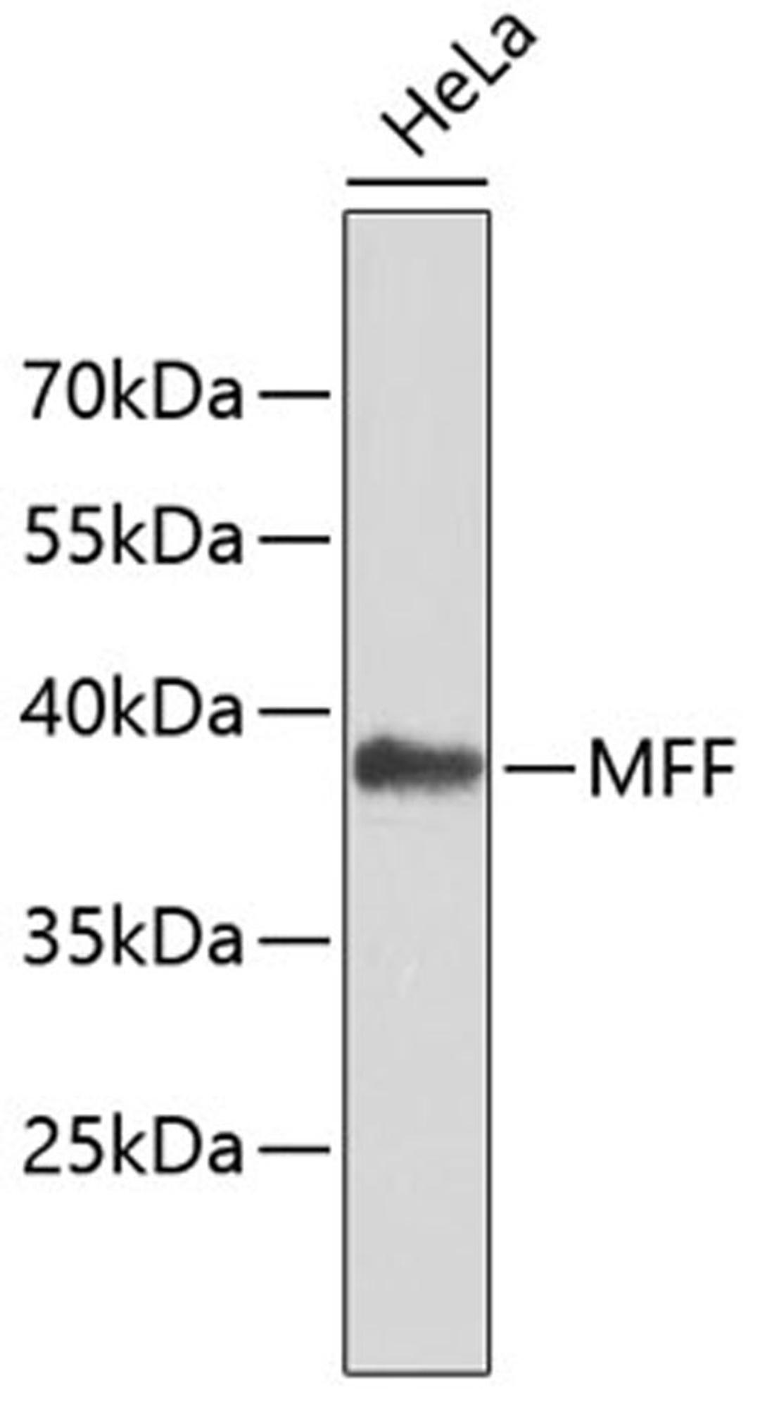 Western blot - MFF antibody (A4874)